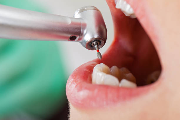 Best Emergency Treatment for Oral Infections in Buckley, WA